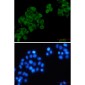 RRM1 Rabbit mAb ABZ3153
