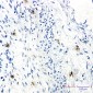 RRM1 Rabbit mAb ABZ3153