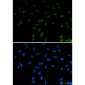 SFPQ Rabbit mAb ABZ3161