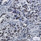 SFPQ Rabbit mAb ABZ3161
