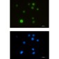 SMARCA5 Rabbit mAb ABZ3169