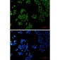 SP1 Rabbit mAb ABZ3174