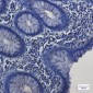 SP1 Rabbit mAb ABZ3174
