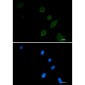 Synaptophysin Rabbit mAb ABZ3181