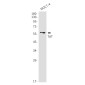 TdT Rabbit mAb ABZ3192