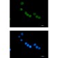 Thymidylate Synthase Rabbit mAb ABZ3197