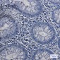 Topoisomerase I Rabbit mAb ABZ3204