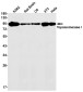 Topoisomerase I Rabbit mAb ABZ3204