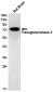 Transglutaminase 2 Rabbit mAb ABZ3206