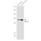 VDAC1/Porin Rabbit mAb ABZ3223