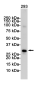 VDAC1/Porin Rabbit mAb ABZ3223