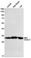 VDAC1/Porin Rabbit mAb ABZ3223