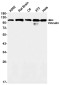 Vinculin Rabbit mAb ABZ3228
