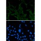 ACADM/MCAD Rabbit mAb ABZ3253