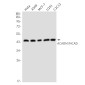 ACADM/MCAD Rabbit mAb ABZ3253