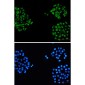 alpha Internexin Rabbit mAb ABZ3256