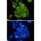 BubR1 Rabbit mAb ABZ3264