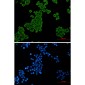 EEF2/Elongation factor 2 Rabbit mAb ABZ3288