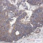 EEF2/Elongation factor 2 Rabbit mAb ABZ3288