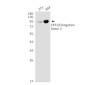 EEF2/Elongation factor 2 Rabbit mAb ABZ3288