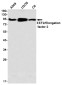 EEF2/Elongation factor 2 Rabbit mAb ABZ3288