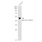 gamma Tubulin Rabbit mAb ABZ3303