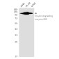 Insulin degrading enzyme Rabbit mAb ABZ3321
