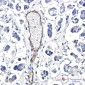 Poliovirus Receptor/PVR Rabbit mAb ABZ3352