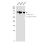 Poliovirus Receptor/PVR Rabbit mAb ABZ3352
