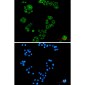Alkaline Phosphatase Rabbit mAb ABZ3409