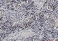 Alkaline Phosphatase Rabbit mAb ABZ3409