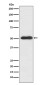 Slit2 Rabbit mAb ABZ3818