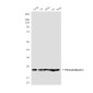 Peroxiredoxin 1/PAG (6A6) Mouse mAb ABZ3903