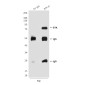 BTK (5B12) Mouse mAb ABZ3905