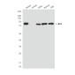 BTK (5B12) Mouse mAb ABZ3905
