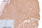 Cytokeratin 17 (8C6) Mouse mAb ABZ3909