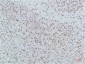 PPAR delta (4F4) Mouse mAb ABZ3914