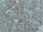 Smad2/3 (6F7) Mouse mAb ABZ3921