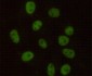 DNA PKcs (6D1) Mouse mAb ABZ3922