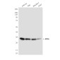 RPS6 (7B10) Mouse mAb ABZ3928