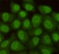 hHR23B (5H1) Mouse mAb ABZ3939
