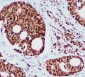 hHR23B (5H1) Mouse mAb ABZ3939