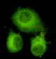 ATP Citrate Lyase (3D9) Mouse mAb ABZ3940