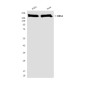BRG1 (4E11) Mouse mAb ABZ3948