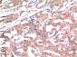 GSK3 beta (9F9) Mouse mAb ABZ3950