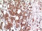 GSK3 beta (9B1) Mouse mAb ABZ3951