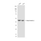 beta Arrestin 1 (6A1) Mouse mAb ABZ3955