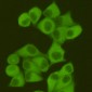 Fatty Acid Synthase (2F9) Mouse mAb ABZ3957