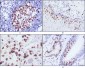 Ki67 (10B6) Mouse mAb ABZ3960