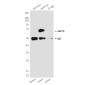ZAP70 (4B2) Mouse mAb ABZ3965